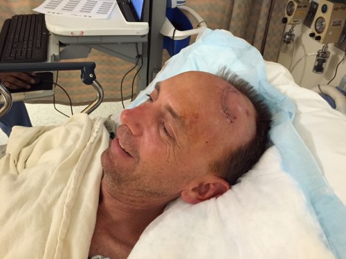 It's a good thing scars on guys are "rugged and sexy"...